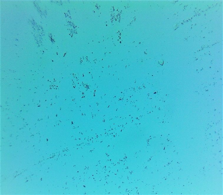 Microscope view at ten times magnification of the DRP Accelerator jar, showing a dense cluster of bacteria.