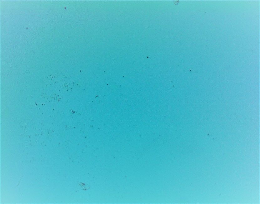Microscope view at ten times magnification of the untreated well water jar, showing a sparse scatter of bacteria.